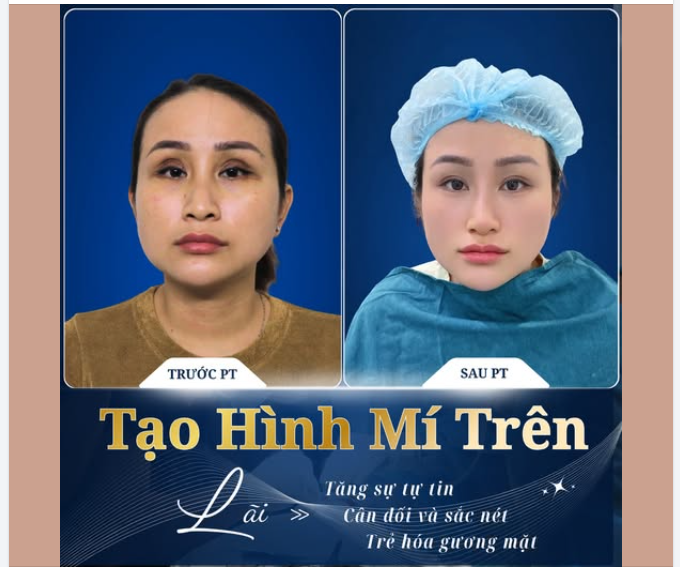 ĐỪNG ĐỂ "GIÁ RẺ" LÀM HỎNG ĐÔI MẮT BẠN!