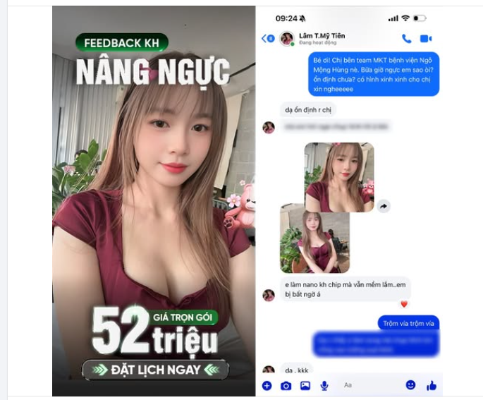 "Em làm Nano không chip mà vẫn mềm lắm. Em bị bất ngờ á" - Chia sẻ của nàng thơ sau khi nâng cấp V1 tại BV PTTM Ngô Mộng Hùng