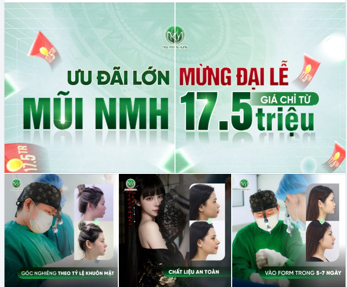 60P Sở Hữu Dáng Mũi "Trong Mơ" Đón Đại Lễ !