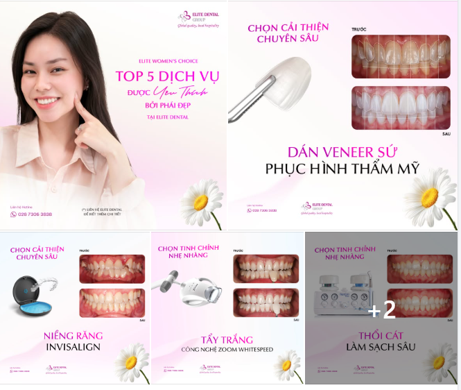 TOP 5 DỊCH VỤ ĐƯỢC YÊU THÍCH BỞI PHÁI ĐẸP TẠI ELITE DENTAL