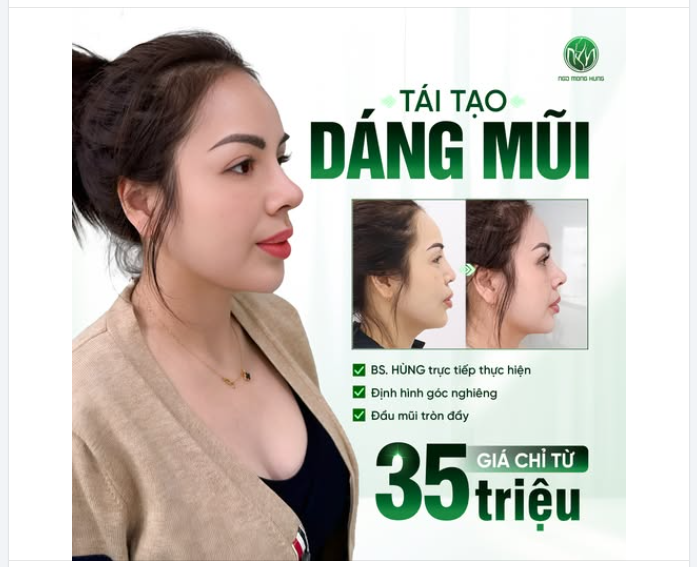 Tái cấu trúc dáng mũi giúp gương mặt hài hòa hơn như thế nào?