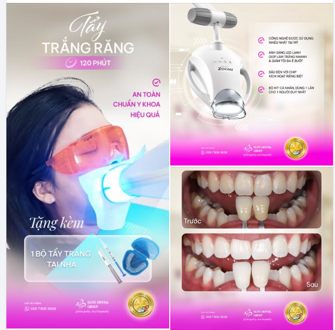 BẬT "TONE" RĂNG Ố VÀNG SAU 120 PHÚT TẨY TRẮNG AN TOÀN, CHUẨN Y KHOA