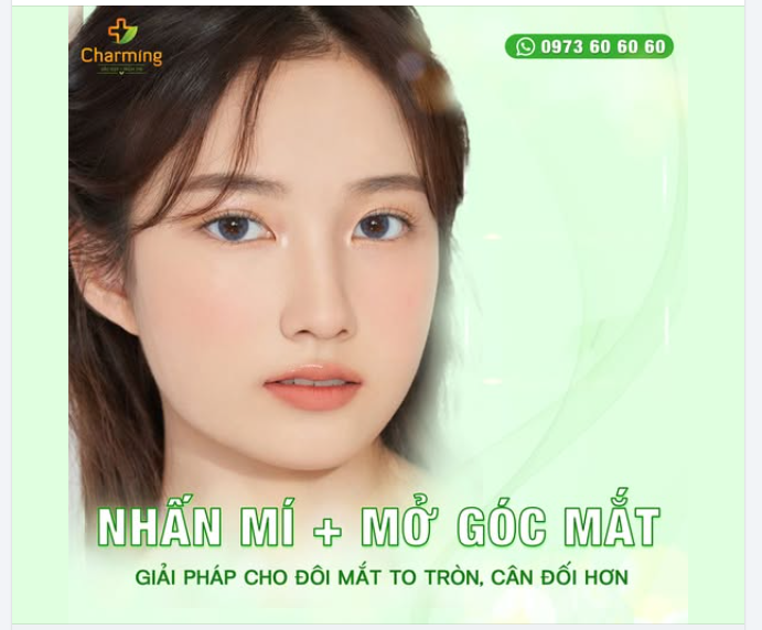 NHẤN MÍ KẾT HỢP MỞ GÓC MẮT – GIẢI PHÁP CHO ĐÔI MẮT TO, TỈ LỆ HÀI HÒA