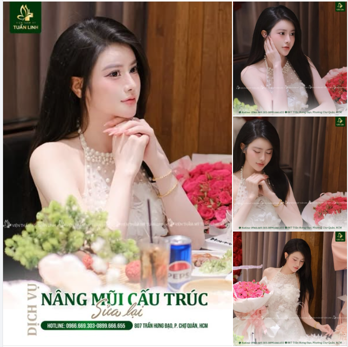 NÂNG MŨI CẤU TRÚC SỬA LẠI – GIẢI PHÁP CHO MŨI HỎNG, MŨI SỬA NHƯNG CHƯA ĐẸP