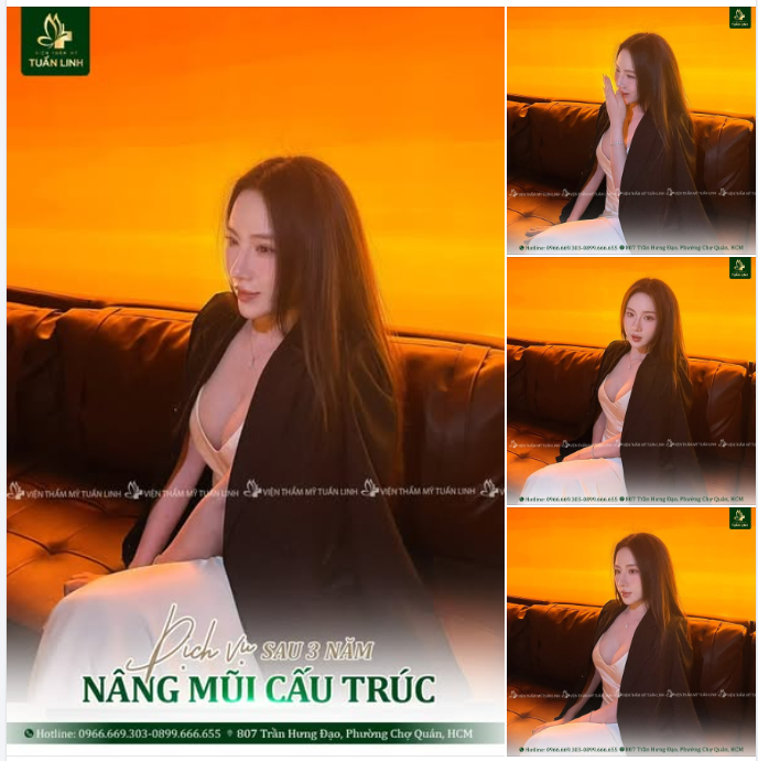 FEEDBACK SAU 3 NĂM NÂNG MŨI – ĐẸP BỀN VỮNG THEO THỜI GIAN