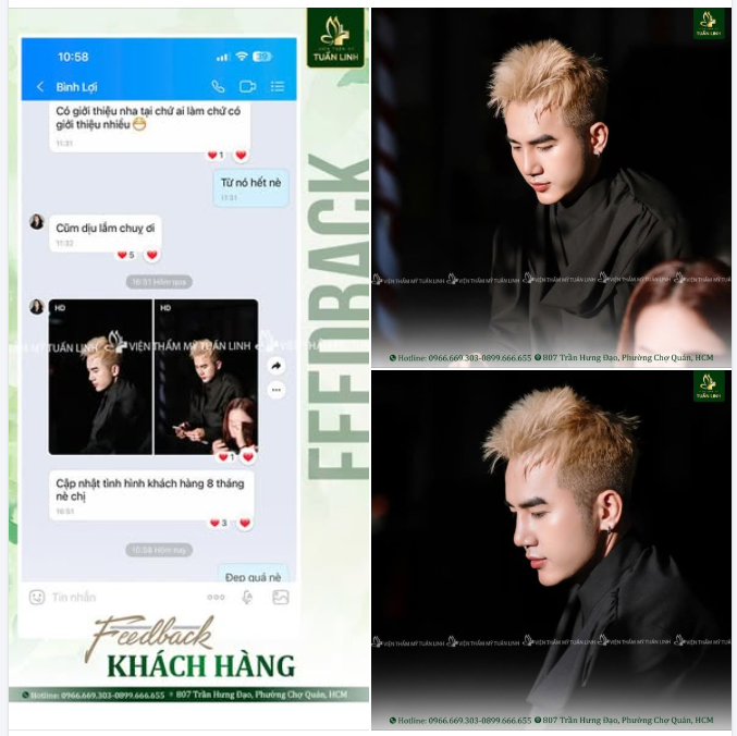 DÁNG MŨI NAM SAU 8 THÁNG – CÀNG NHÌN CÀNG ƯNG