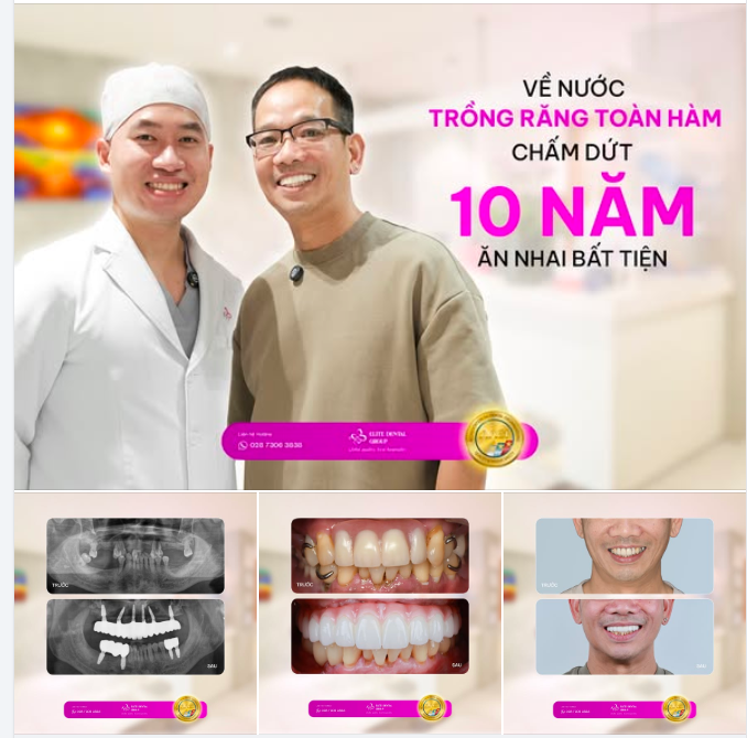 SỚM PHỤC HỒI RĂNG MẤT - ĐỂ KHÔNG BỎ LỠ NHỮNG NIỀM VUI SỐNG