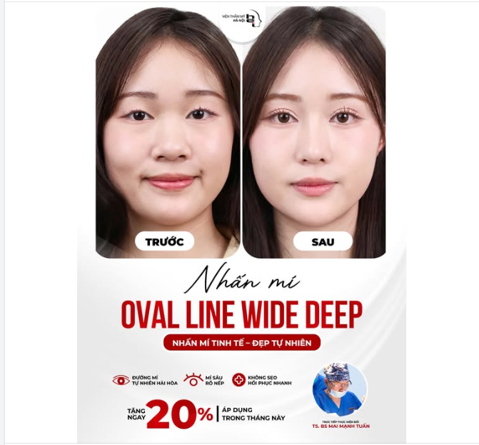 30 PHÚT LÊN HẠNG VISUAL – SỞ HỮU ĐÔI MẮT BIẾT NÓI