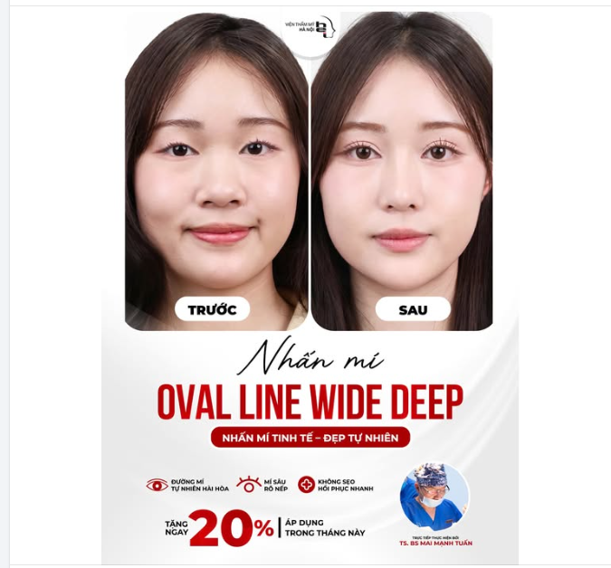 30 PHÚT LÊN HẠNG VISUAL – SỞ HỮU ĐÔI MẮT BIẾT NÓI