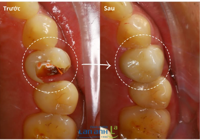 Giờ ăn nhai khỏe, cười xinh mỗi ngày