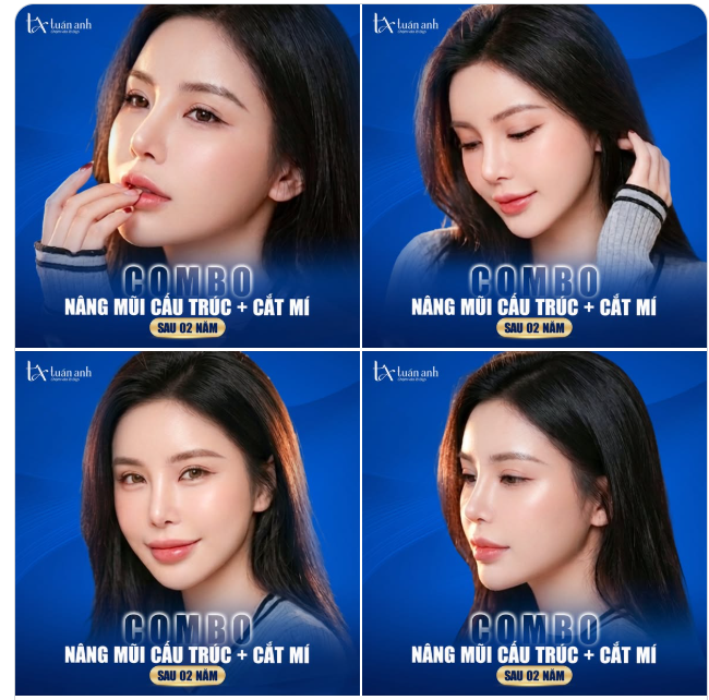 Điều tuyệt vời nhất sau 02 năm không chỉ là những đường nét chuẩn tỷ lệ, mà là thần thái tự tin trong từng ánh mắt, nụ cười của khách hàng.
