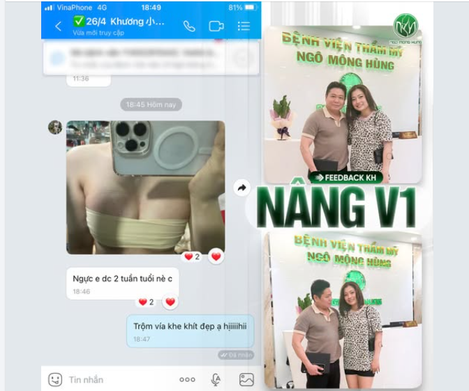 Feedback KH sau 2 tuần nâng V1 form đầy đặn, nhìn là thấy ưng liền. Trộm vía hôm nay tái khám còn tranh thủ chụp hình kỷ niệm với bác Hùng nữa