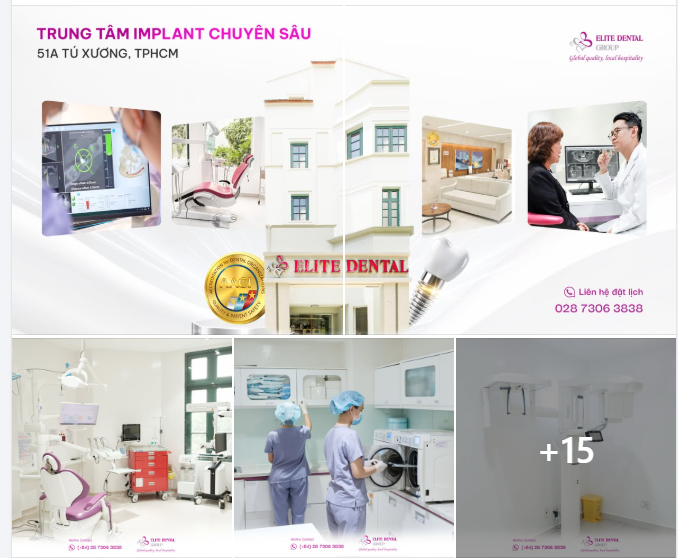 TRỒNG RĂNG IMPLANT Ở TP.HCM THÌ ĐẾN ĐÂU?