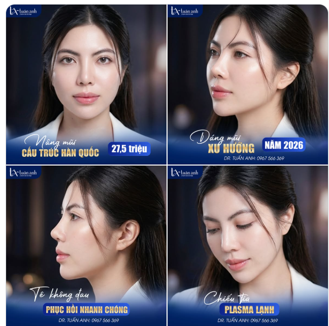 DÁNG MŨI DẪN ĐẦU XU HƯỚNG NĂM 2026