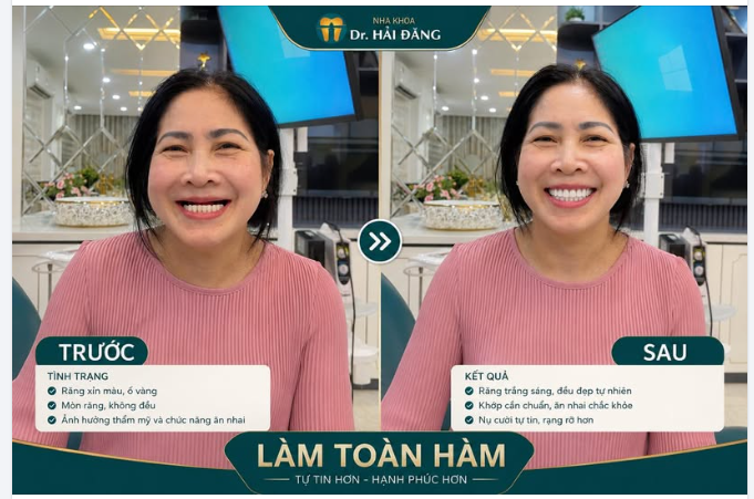 HÀNH TRÌNH TÌM LẠI NỤ CƯỜI CỦA CHỊ LOAN - VIỆT KIỀU ĐỨC