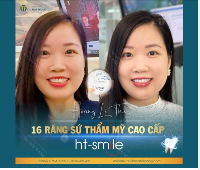 LỘT XÁC NỤ CƯỜI - TỰ TIN TOẢ SÁNG MỖI NGÀY