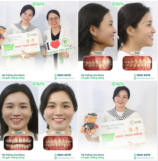 THU MAI THÁO NIỀNG - KHI NỤ CƯỜI “ĐI ĐÚNG HƯỚNG