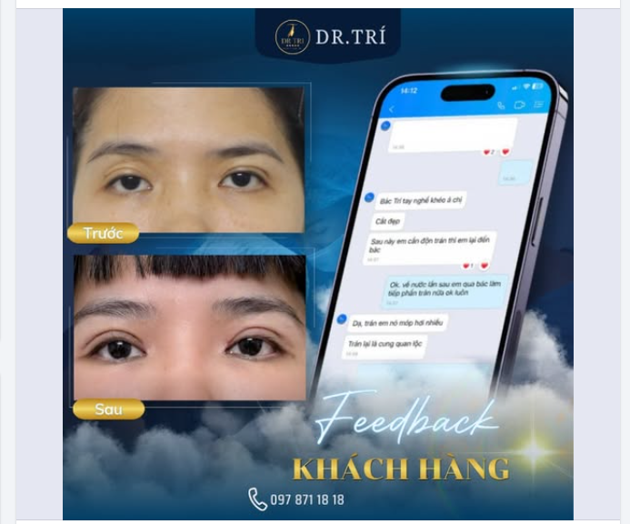 FEEDBACK TỪ KHÁCH HÀNG SAU KHI THỰC HIỆN DỊCH VỤ TẠI DR. TRÍ