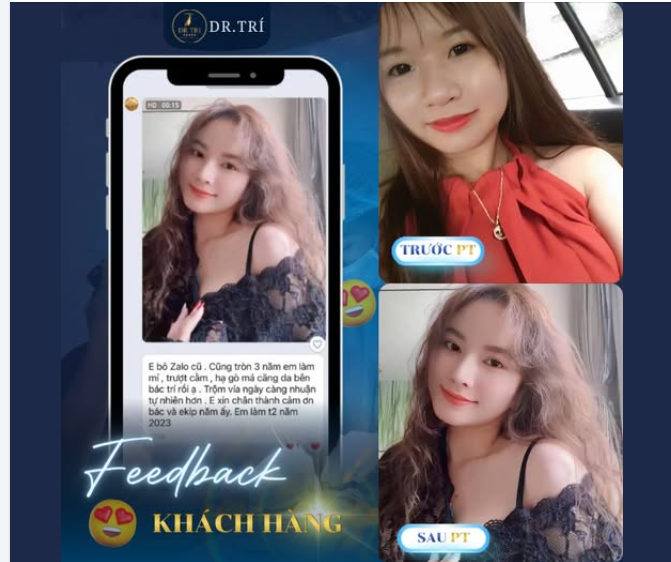 KIẾN TẠO GƯƠNG MẶT TỶ LỆ VÀNG CÙNG DR. TRÍ