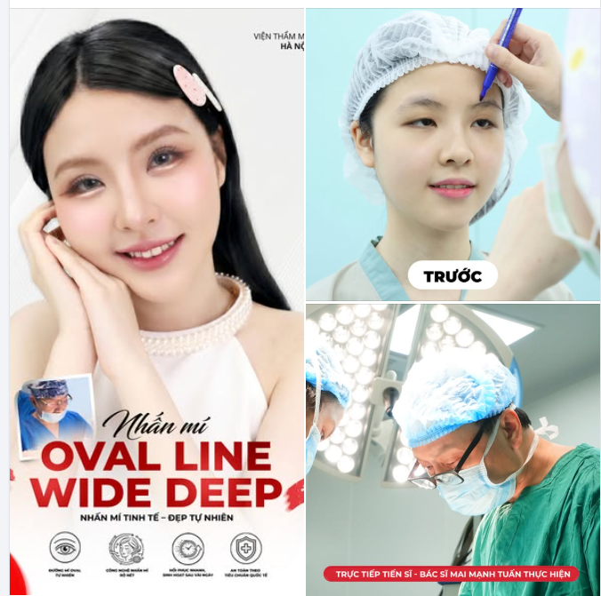 30 PHÚT LÊN HẠNG VISUAL – SỞ HỮU ĐÔI MẮT BIẾT NÓI