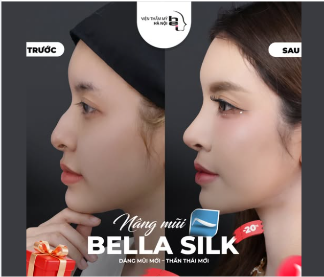 NÂNG MŨI BELLA SILK - MŨI ĐẸP TỰ NHIÊN