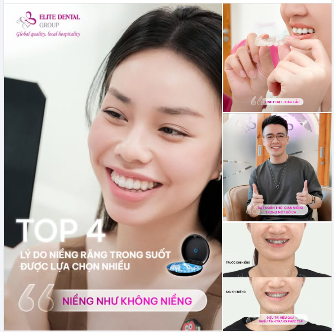 NIỀNG KHAY TRONG SUỐT VÌ THẨM MỸ  NIỀNG KHAY TRONG SUỐT VÌ THẨM MỸ, LINH HOẠT VÀ HIỆU QUẢ