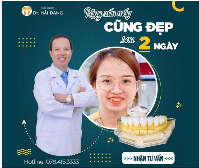 RĂNG XẤU MẤY – CŨNG ĐẸP SAU 2 NGÀY
