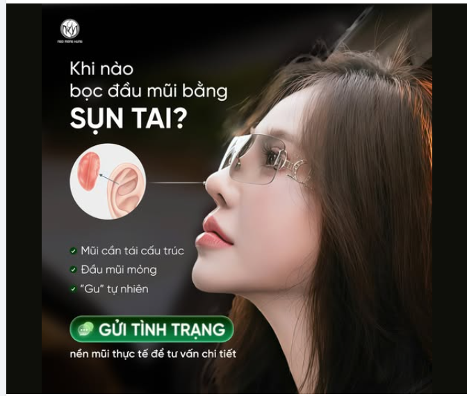 Khi nào cần bọc đầu mũi bằng sụn tai?