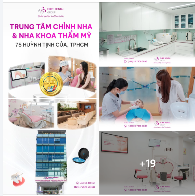 TÌM NƠI NIỀNG RĂNG CẢI THIỆN THẨM MỸ NỤ CƯỜI UY TÍN Ở TP.HCM?