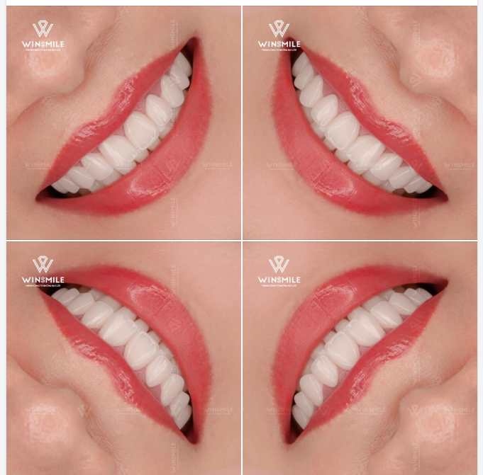 KHI CÔNG NGHỆ NHƯỜNG CHỖ CHO CẢM QUAN DUY MỸ