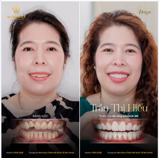 Sự thay đổi không diễn ra ngày 1 ngày 2 mà là cả một hành trình của sự tin tưởng, của những lần trở về và mong muốn được hoàn thiện bản thân theo cách đẹp nhất.