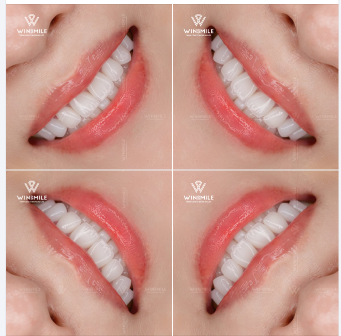 Một bộ trang phục thời thượng có thể lỗi mốt sau một mùa. Một kiểu tóc cá tính có thể thay đổi sau vài tháng.