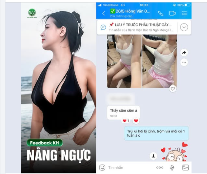 Feedback nâng V1 sau 1 tuần tại BV PTTM Ngô Mộng Hùng