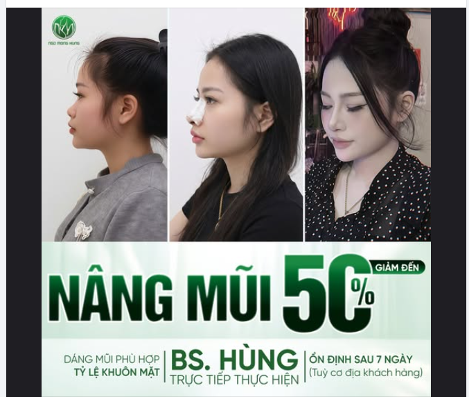 “Em tính…” , “Em dự định…” , “Em muốn nâng mũi nhưng…”,