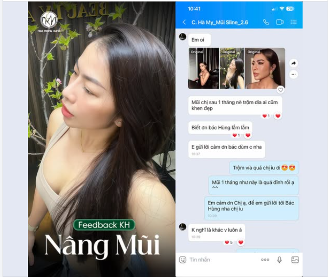 Xu cà na thì mình chê,  chứ xu hướng nâng mũi tại BV PTTM Ngô Mộng Hùng thì mê không lối về