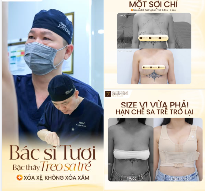 TREO VÒNG 1 XỆ NẶNG - GIỮ TRỌN HÌNH XĂM BỞI ĐÔI BÀN TÀI HOA CỦA BÁC SĨ TƯƠI