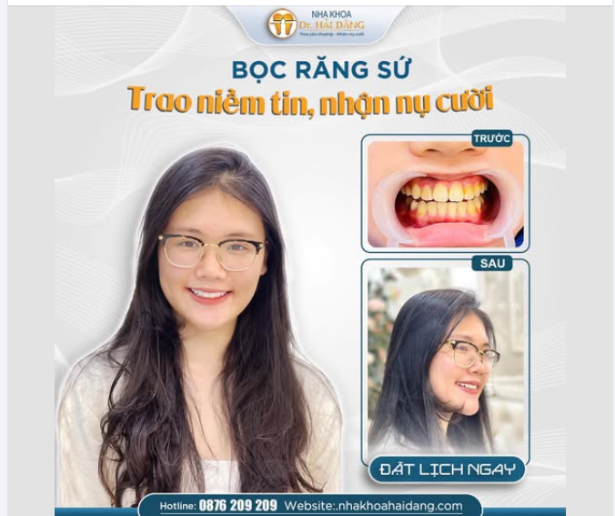 BỌC RĂNG SỨ – TRAO NIỀM TIN - NHẬN NỤ CƯỜI