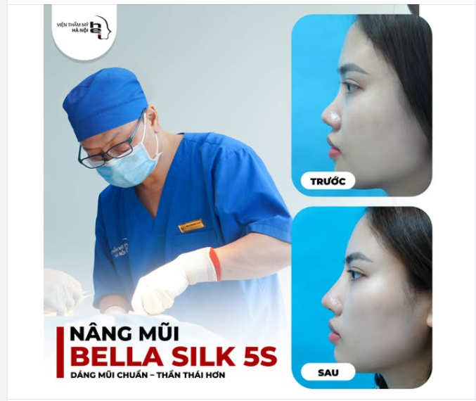 NÂNG MŨI BELLA SILK - MŨI ĐẸP TỰ NHIÊN
