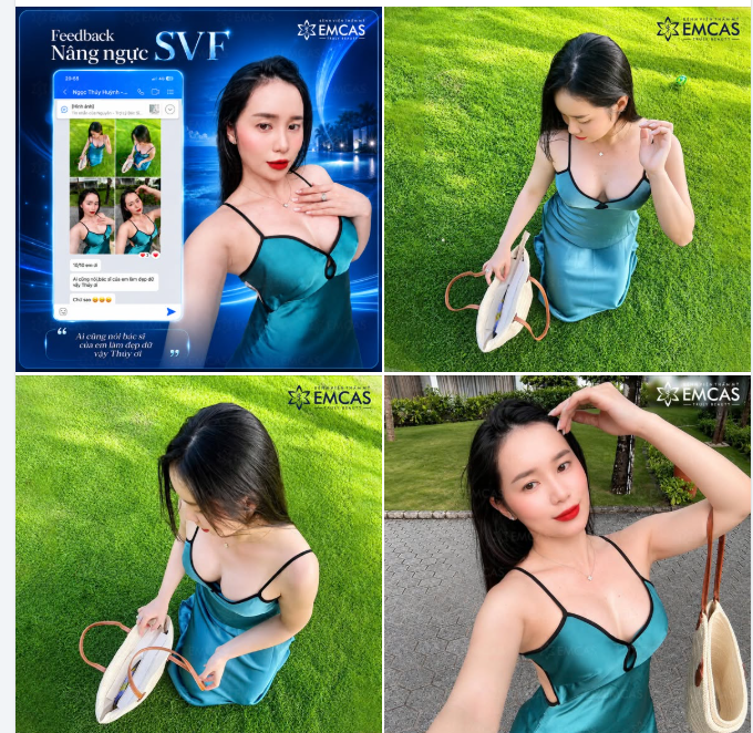 Mới 1 tháng sau nâng ngực mà ai nhìn cũng phải trầm trồ