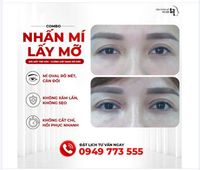 MẮT ĐẸP LÀ VISUAL LÊN HƯƠNG NGAY LẬP TỨC!