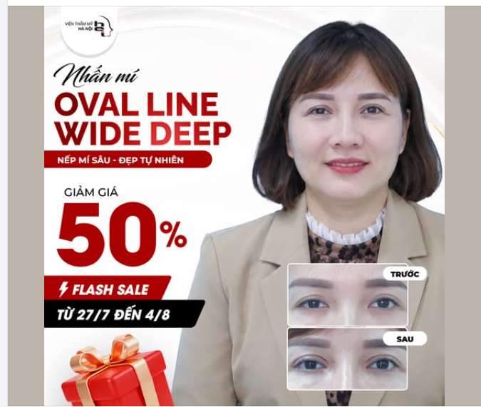 FLASH SALE - NHẤN MÍ OVAL LINE WIDE DEEP