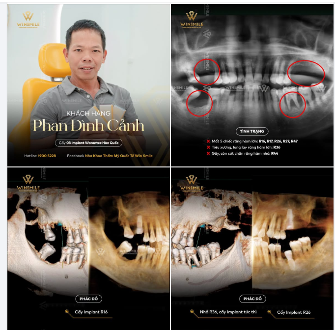 Lộ trình cá nhân hóa - Từng bước rõ ràng cho lợi ích tối ưu