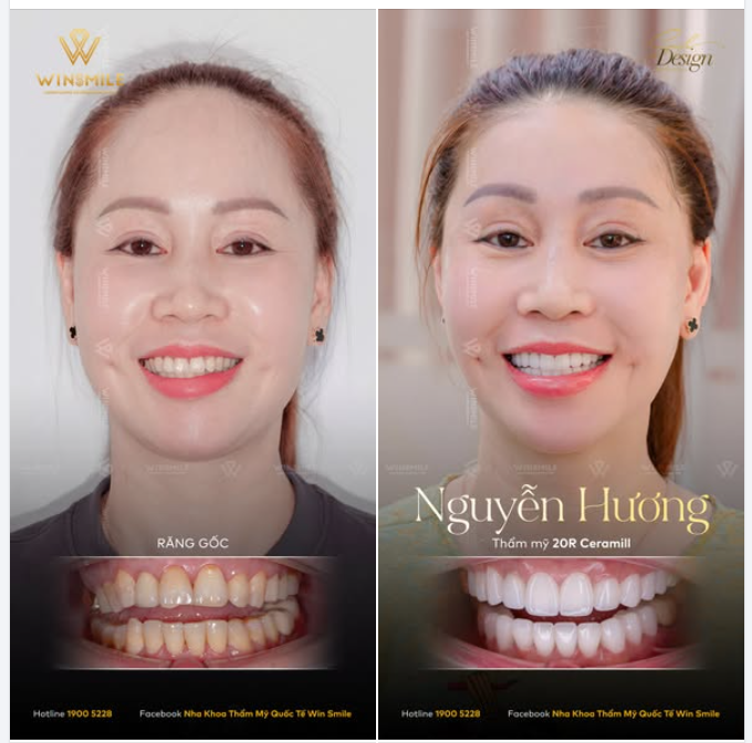 Có những sự thay đổi không cần lên tiếng quá phô trương, nhưng ai cũng có thể cảm nhận được qua ánh mắt, bờ môi và nguồn năng lượng rạng rỡ tỏa ra từ một diện mạo mới