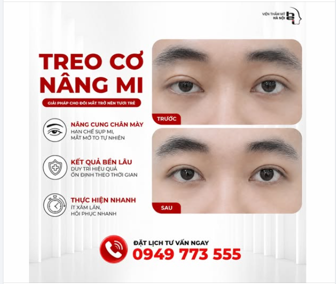 MẮT TO – MẮT NHỎ KHIẾN GƯƠNG MẶT LỜ ĐỜ KÉM SẮC?