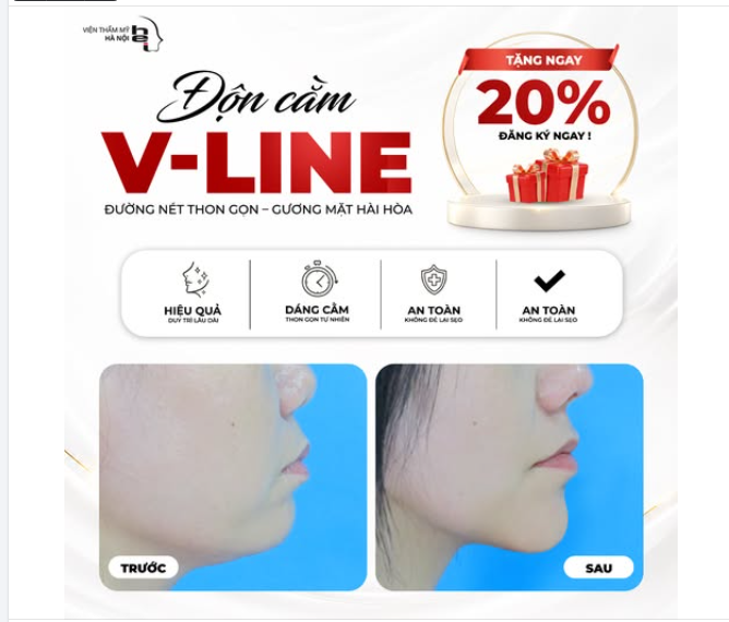 GÓC NGHIÊNG "MẤT TÍCH" CHỈ VÌ CẰM LẸM – GIẢI CỨU DIỆN MẠO CHỈ SAU 30 PHÚT!