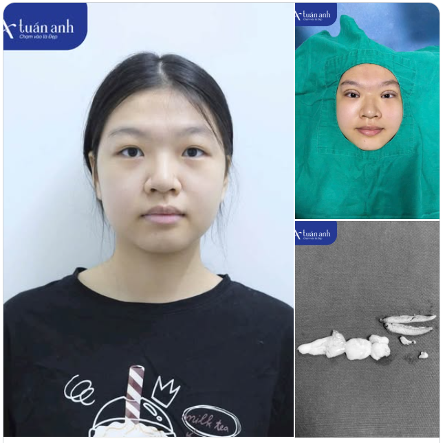 ĐẶC BIỆT: Mừng sinh nhật 6 tuổi Thẩm mỹ Tuấn Anh