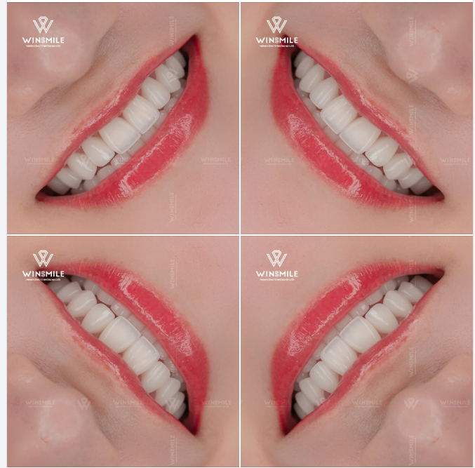 Có những nụ cười chẳng cần rực rỡ phô trương, chỉ cần đủ nhẹ nhàng và hài hòa để khiến ai đó lỡ nhìn rồi lại muốn ngắm mãi.