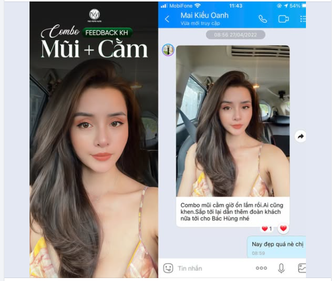 "Combo mũi cằm giờ ổn định ai cũng khen. Sắp tới lại dẫn thêm bạn nữa tới cho Bác Hùng làm..." - Khách hàng chia sẻ