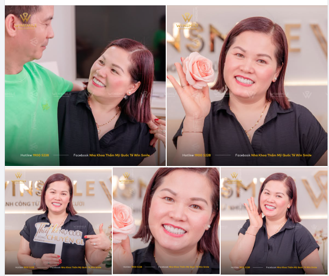 Suốt từ những ngày đầu bước chân tới Win Smile, từ buổi tư vấn đầu tiên, cho tới khoảnh khắc cầm gương ngắm nhìn nụ cười mới - bên cạnh chị Thảo luôn có bóng dáng của mẹ.