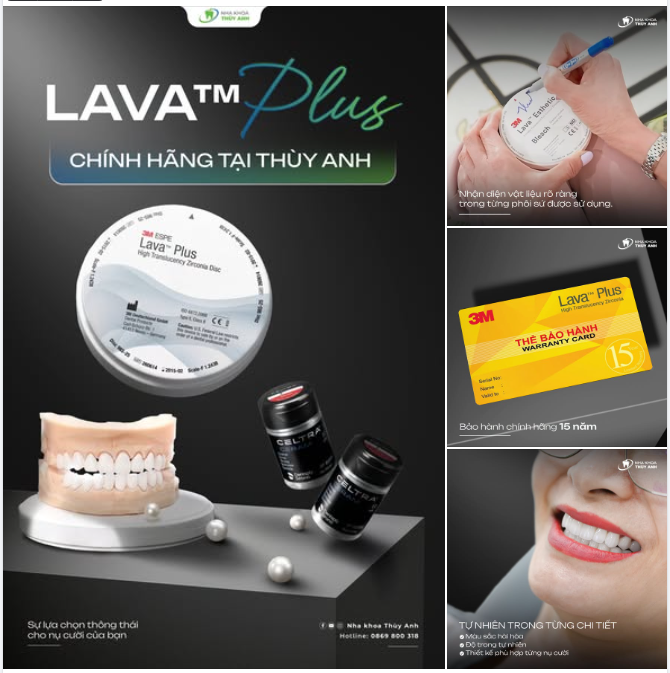 LAVA™ PLUS - SỰ LỰA CHỌN THÔNG THÁI CHO NỤ CƯỜI